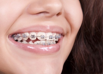 Orthodontics